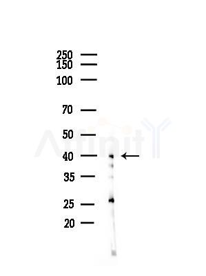 TIA1 Antibody - Western blot analysis of lysates from HepG2 cells(heat-shock,45min treatment), using TIA1 Antibody at 1/1000 dilution.