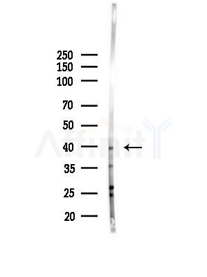 TIA1 Antibody - Western blot analysis of lysates from COLO205 cells(heat-shock,45min treatment), using TIA1 Antibody at 1/1000 dilution.