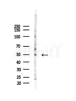 TRIM44 Antibody - Western blot analysis of lysates from COLO205 cells(UV,30min treatment), using TRIM44 Antibody at 1/1000 dilution.