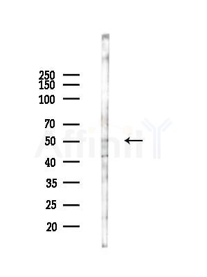 TRIM44 Antibody - Western blot analysis of lysates from LoVo cells(heat-shock,45min treatment), using TRIM44 Antibody at 1/1000 dilution.