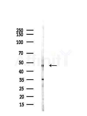 TTLL6 Antibody - Western blot analysis of lysates from COLO205 cells(UV,30min treatment), using TTLL6 Antibody at 1/1000 dilution.