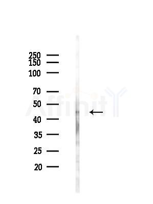 TTLL6 Antibody - Western blot analysis of lysates from LoVo cells(heat-shock,45min treatment), using TTLL6 Antibody at 1/1000 dilution.
