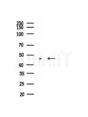 Annexin VII Antibody - Western blot analysis of lysates from B16F10-LUC cells(heat-shock, 45min treatment), using Annexin VII Antibody at 1/1000 dilution.