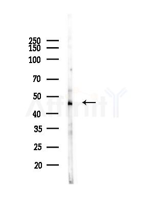 AP1M1 Antibody - Western blot analysis of lysates from B16F10-LUC cells(heat-shock, 45min treatment), using AP1M1 Antibody at 1/1000 dilution.