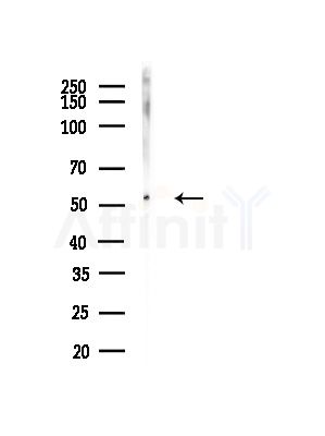BCS1L Antibody - Western blot analysis of lysates from A375 cells(heat-shock, 45min treatment), using BCS1L Antibody at 1/1000 dilution.