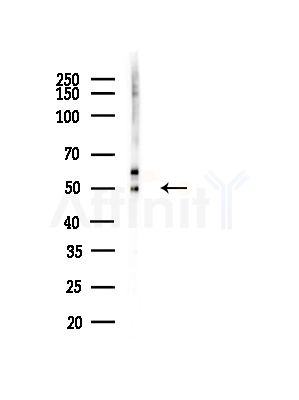 BCS1L Antibody - Western blot analysis of lysates from B16F10-LUC cells(heat-shock, 45min treatment), using BCS1L Antibody at 1/1000 dilution.