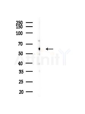 CKAP4 Antibody - Western blot analysis of lysates from A375 cells(heat-shock, 45min treatment), using CKAP4 Antibody at 1/1000 dilution.