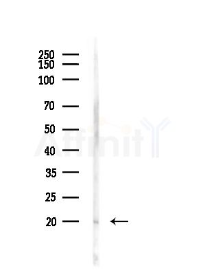 CPLX1 Antibody - Western blot analysis of lysates from Rat brain, using CPLX1 Antibody at 1/1000 dilution.