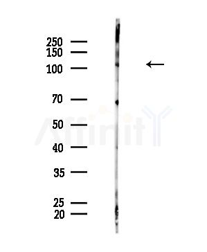 CYLD Antibody - Western blot analysis of lysates from Mouse brain, using CYLD Antibody at 1/1000 dilution.