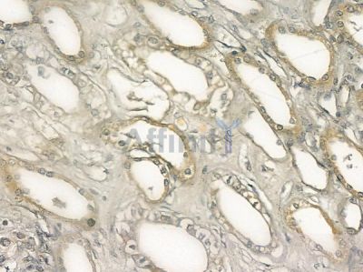D2HGDH Antibody - DF12195 at 1/100 staining human normal kidney tissue by IHC-P.