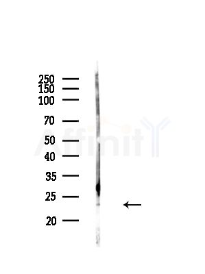 Dermatopontin Antibody - Western blot analysis of lysates from A375 cells(heat-shock,45min treatment), using Dermatopontin Antibody at 1/1000 dilution.