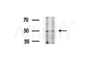 DNAJB14 Antibody - Western blot analysis of extracts from HepG2 cells(heat-shock treatment), using DNAJB14 Antibody at 1/1000 dilution.