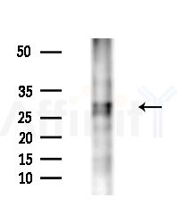 ETFB Antibody - Western blot analysis of extracts from Mouse liver, using ETFB Antibody at 1/1000 dilution.