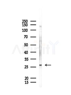 GSTA4 Antibody - Western blot analysis of lysates from Rat lung, using GSTA4 Antibody at 1/1000 dilution.