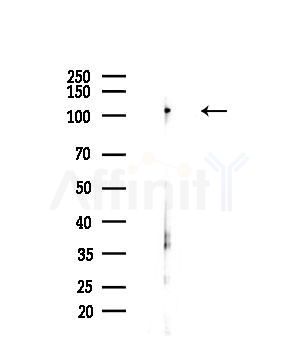 IPO4 Antibody - Western blot analysis of lysates from LoVo cells(heat-shock,45min treatment), using IPO4 Antibody at 1/1000 dilution.