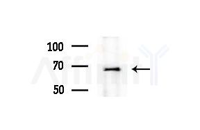 LARP7 Antibody - Western blot analysis of extracts from COLO205 cells(heat-shock treatment), using LARP7 Antibody at 1/1000 dilution.