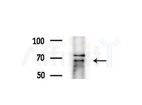 LARP7 Antibody - Western blot analysis of extracts from HepG2 cells(heat-shock treatment), using LARP7 Antibody at 1/1000 dilution.