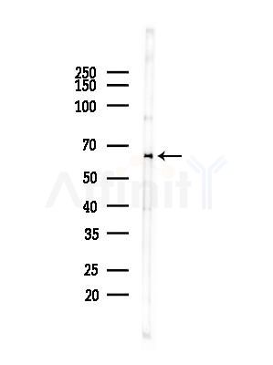 LARP7 Antibody - Western blot analysis of lysates from HepG2 cells(heat-shock,45min treatment), using LARP7 Antibody at 1/1000 dilution.