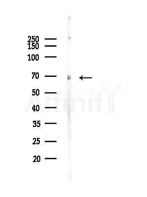 LMNB2 Antibody - Western blot analysis of lysates from B16F10-LUC cells(heat-shock, 45min treatment), using LMNB2 Antibody at 1/1000 dilution.