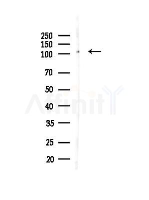 MMS19 Antibody - Western blot analysis of lysates from PC12 cells(heat-shock,45min treatment), using MMS19 Antibody at 1/1000 dilution.