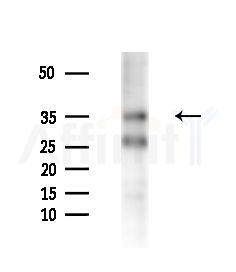 MTHFD2 Antibody - Western blot analysis of extracts from HepG2 cells(starvation,24h treatment), using MTHFD2 Antibody at 1/1000 dilution.