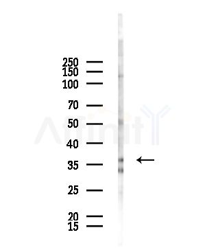 MTHFD2 Antibody - Western blot analysis of lysates from HepG2 cells(starvation,24h treatment), using MTHFD2 Antibody at 1/1000 dilution.