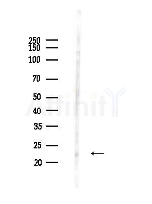 OIP5 Antibody - Western blot analysis of lysates from HepG2 cells(heat-shock,45min treatment), using OIP5 Antibody at 1/1000 dilution.