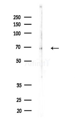 P4HA1 Antibody - Western blot analysis of lysates from A375 cells(LPS,4h treatment), using P4HA1 Antibody at 1/1000 dilution.