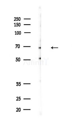P4HA1 Antibody - Western blot analysis of lysates from Mouse testis, using P4HA1 Antibody at 1/1000 dilution.