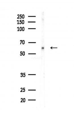 P4HA1 Antibody - Western blot analysis of lysates from Hela cells(heat-shock,45min treatment), using P4HA1 Antibody at 1/1000 dilution.