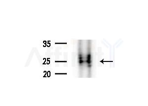 PPPDE1/PNAS4 Antibody - Western blot analysis of extracts from COLO205 cells(heat-shock treatment), using PPPDE1/PNAS4 Antibody at 1/1000 dilution.