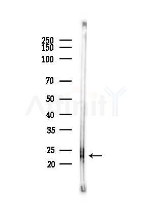 PPPDE1/PNAS4 Antibody - Western blot analysis of lysates from COLO205 cells(heat-shock,45min treatment), using PPPDE1/PNAS4 Antibody at 1/1000 dilution.