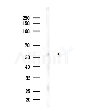 RCN2 Antibody - Western blot analysis of lysates from Hela cells(heat-shock,45min treatment), using RCN2 Antibody at 1/1000 dilution.