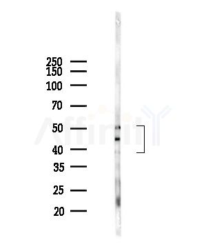 RSAD2 Antibody - Western blot analysis of lysates from Hela cells(heat-shock,45min treatment), using RSAD2 Antibody at 1/1000 dilution.