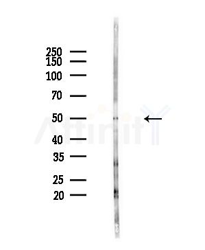 RSAD2 Antibody - Western blot analysis of lysates from PC12 cells(starvation,24h treatment), using RSAD2 Antibody at 1/1000 dilution.