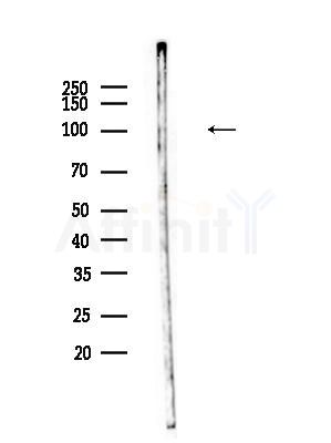 SECISBP2 Antibody - Western blot analysis of lysates from HepG2 cells(heat-shock,45min treatment), using SECISBP2 Antibody at 1/1000 dilution.
