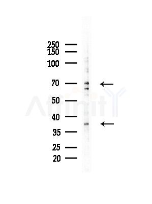 SEPT9 Antibody - Western blot analysis of lysates from COLO205 cells(heat-shock,45min treatment), using SEPT9 Antibody at 1/1000 dilution.