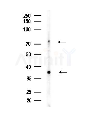 SEPT9 Antibody - Western blot analysis of lysates from Hela cells(heat-shock,45min treatment), using SEPT9 Antibody at 1/1000 dilution.