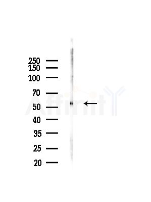 SPTLC2 Antibody - Western blot analysis of lysates from Hela cells(starvation,24h treatment), using SPTLC2 Antibody at 1/1000 dilution.