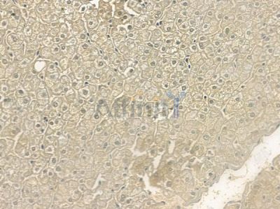 SPTLC2 Antibody - DF12231 at 1/100 staining human normal liver tissue by IHC-P.