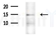SRP9 Antibody - Western blot analysis of extracts from HepG2 cells(starvation treatment), using SRP9 Antibody at 1/1000 dilution.