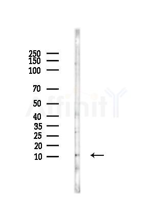 SRP9 Antibody - Western blot analysis of lysates from HepG2 cells(starvation treatment), using SRP9 Antibody at 1/1000 dilution.