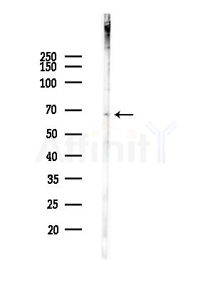 SYVN1 Antibody - Western blot analysis of lysates from A375 cells(heat-shock, 45min treatment), using SYVN1 Antibody at 1/1000 dilution.