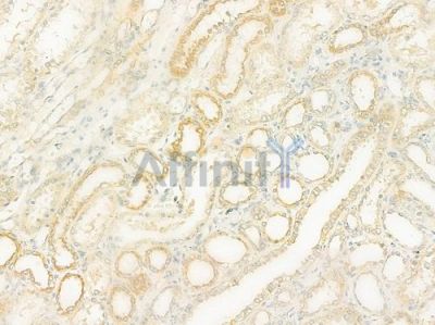 TIM22 Antibody - DF12236 at 1/100 staining human normal kidney tissue by IHC-P.