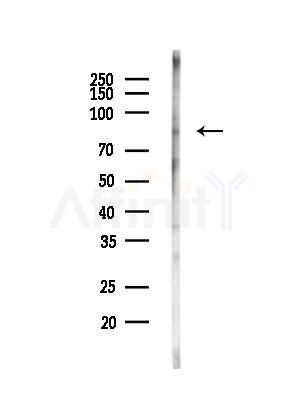 TLE3 Antibody - Western blot analysis of lysates from HUVEC cells(LPC4h treatment), using TLE3 Antibody at 1/1000 dilution.