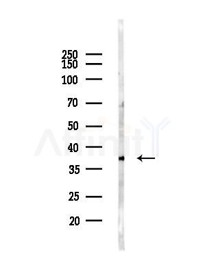 TOM40 Antibody - Western blot analysis of lysates from EC304 cells(heat-shock,45min treatment), using TOM40 Antibody at 1/1000 dilution.