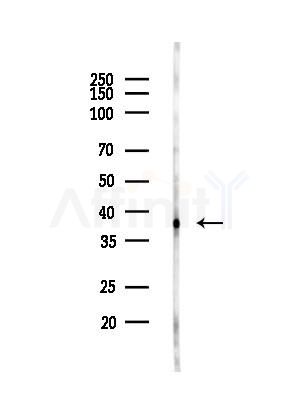 TOM40 Antibody - Western blot analysis of lysates from HUVEC cells(LPC4h treatment), using TOM40 Antibody at 1/1000 dilution.