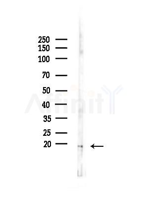 UQCRFS1 Antibody - Western blot analysis of lysates from COLO205 cells(heat-shock,45min treatment), using UQCRFS1 Antibody at 1/1000 dilution.