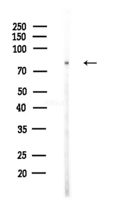 VPS16 Antibody - Western blot analysis of lysates from Hela cells(heat-shock,45min treatment), using VPS16 Antibody at 1/1000 dilution.