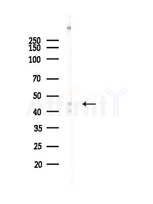 VPS37A Antibody - Western blot analysis of lysates from A375 cells(heat-shock, 45min treatment), using VPS37A Antibody at 1/1000 dilution.